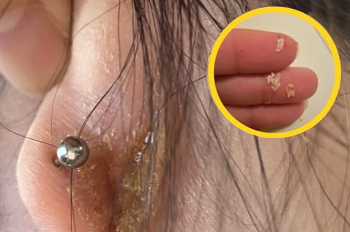 Costras con mal olor detrás de las orejas: Causas y tratamiento