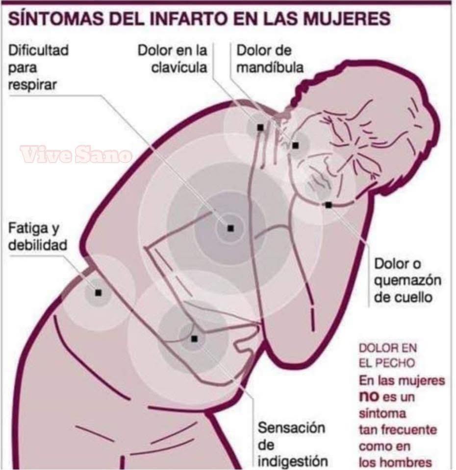 Síntomas de Infarto en Mujeres: Señales de Alerta que No Debes Ignorar ...
